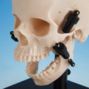 Maximal Open Position