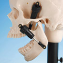 Maximal Open Position