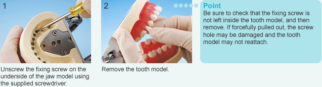 Removing the Tooth Model