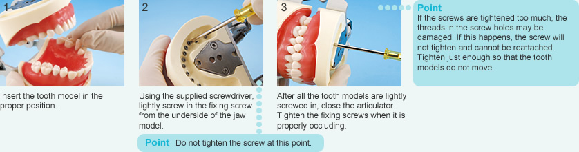 Attaching the Tooth Model