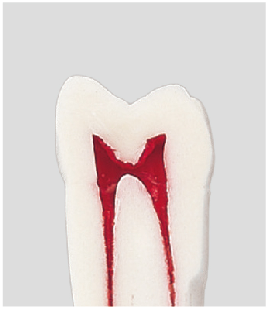 Endodontic Tooth Model [A12AN-200]