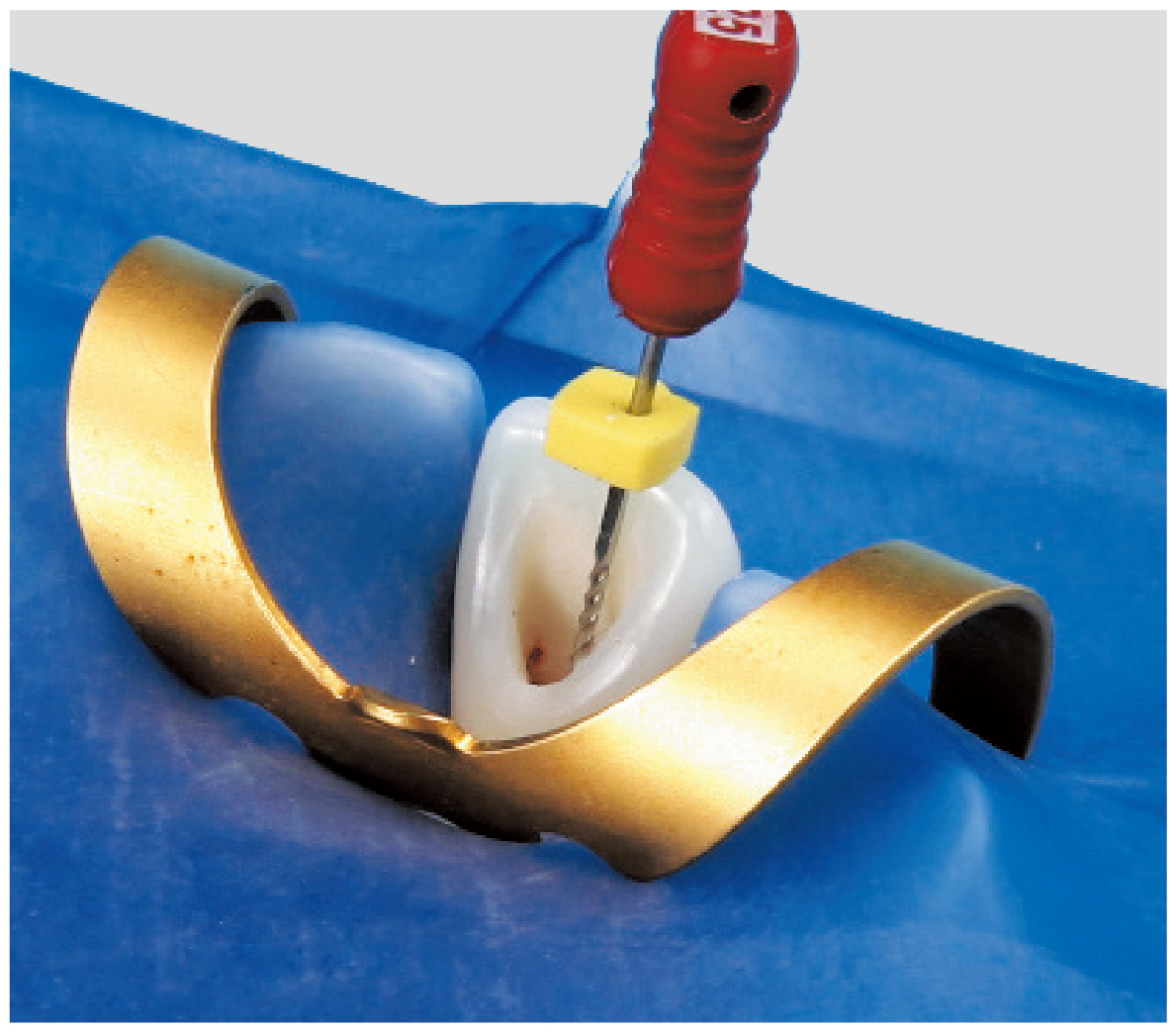 Endodontic Tooth Model [A12AN-200]