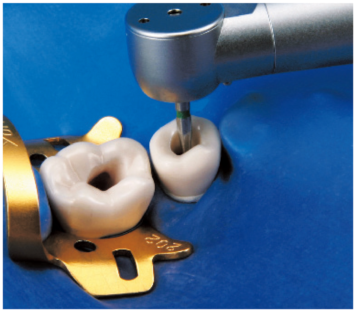Endodontic Tooth Model [A12AN-200]