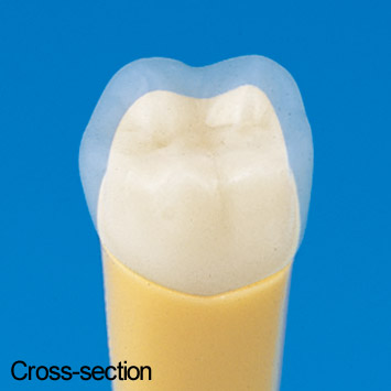 2-Layered Tooth Model [A20AN-500]