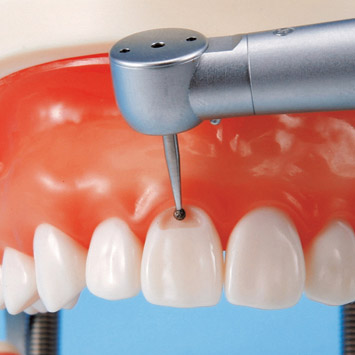 Operative Jaw Model (32 teeth) [CON2001-UL-SP-FEM-32]