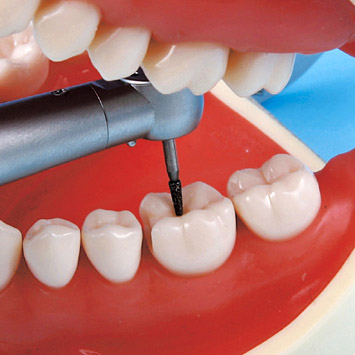 Operative Jaw Model (32 teeth) [CON2001-UL-SP-FEM-32]