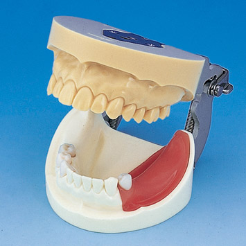 Implant Practice Jaw Model [IMP1001-UL-SP-FEM]