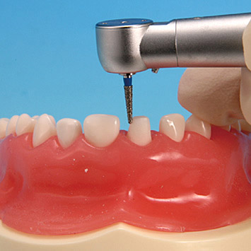 Soft Gingiva Jaw Model (Mixed Dentition) [PDI2001-UL-SP-FEM]