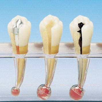 Endodontic Procedure Model [PE-END002]