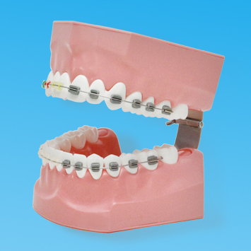 Tooth Brushing Demonstaration Model [PE-ORT002]