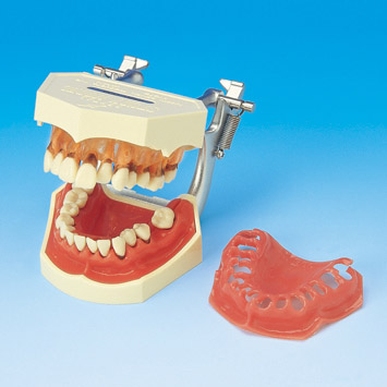 PERIODONTAL DISEASE MODEL [PE-PER001]