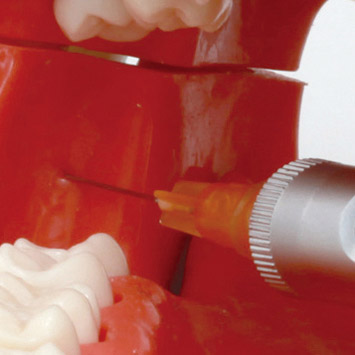 Conduction Anesthesia Model [SUG2005-UL-SP]
