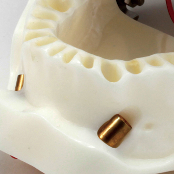 Conduction Anesthesia Model [SUG2005-UL-SP]
