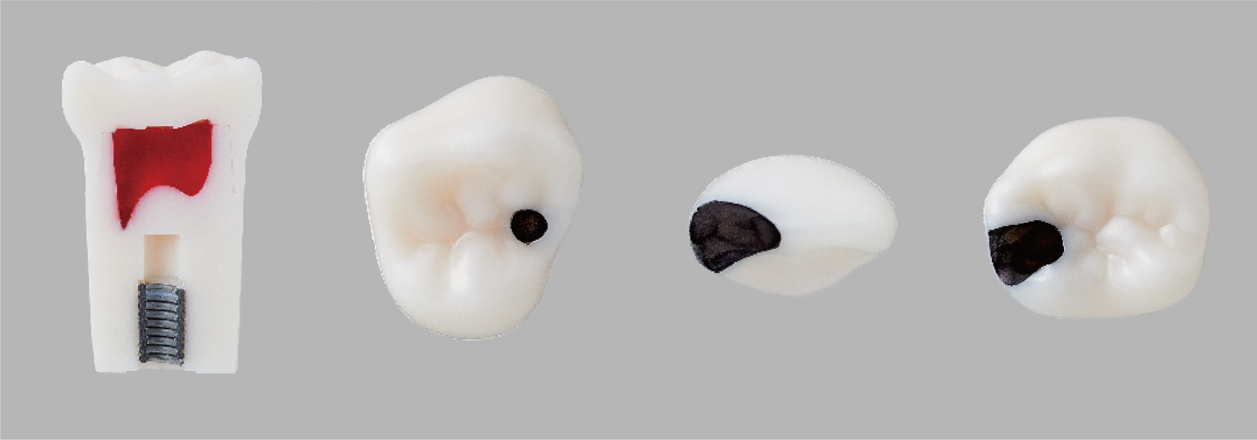 Pedo Endodontic Tooth Model [A12AN Series]