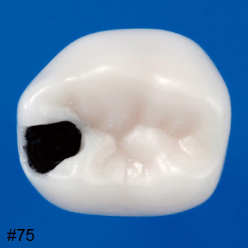 Pedo Endodontic Tooth Model [A12AN Series]