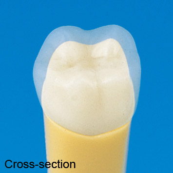 2-Layered Tooth Model [A20AN-200]
