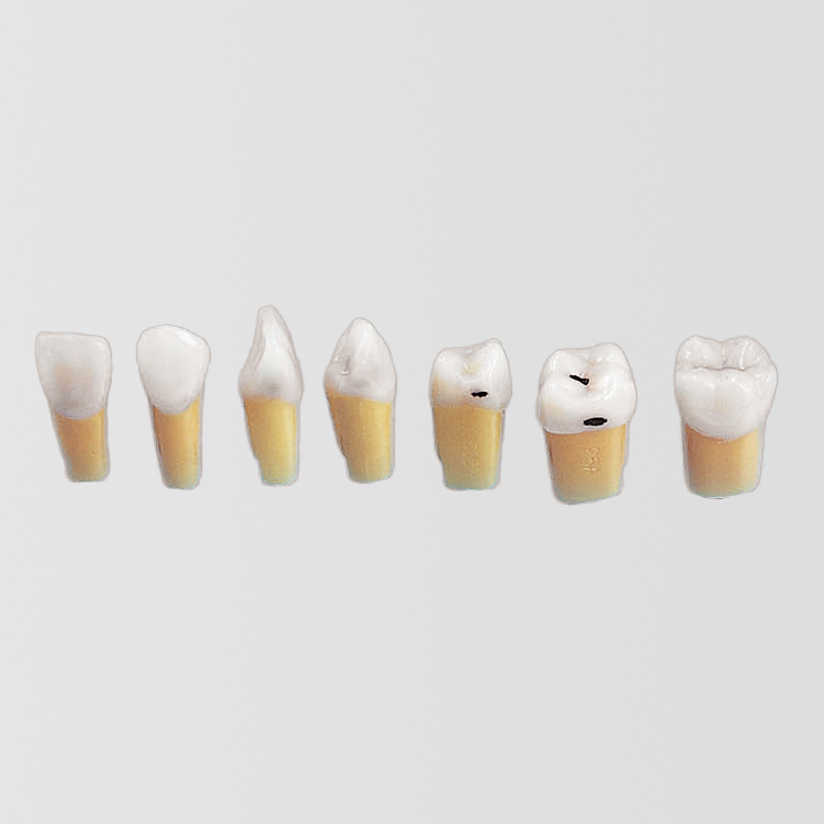 Caries Tooth Model [A27AN Series]