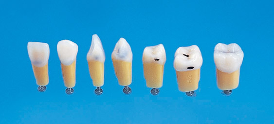 Caries Tooth Model [A27AN Series] | Nissin Dental Products Inc