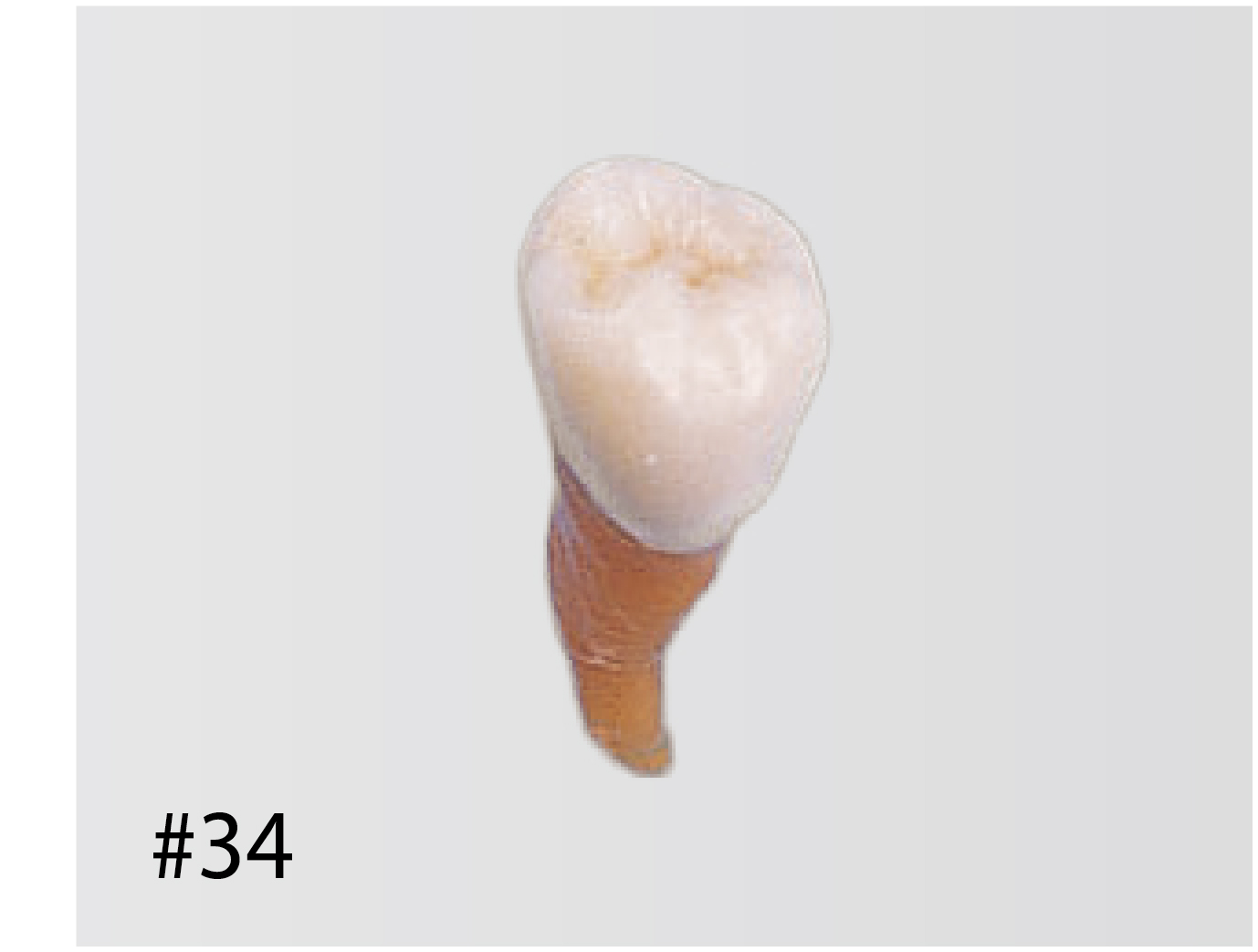 Anatomical Tooth Model [B2-306]