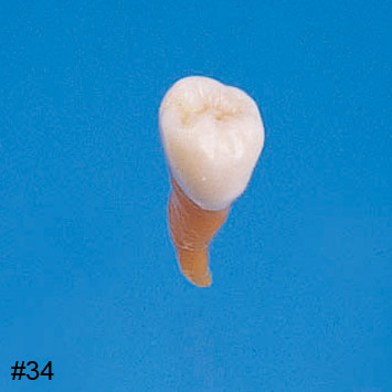 Anatomical Tooth Model [B2-306]
