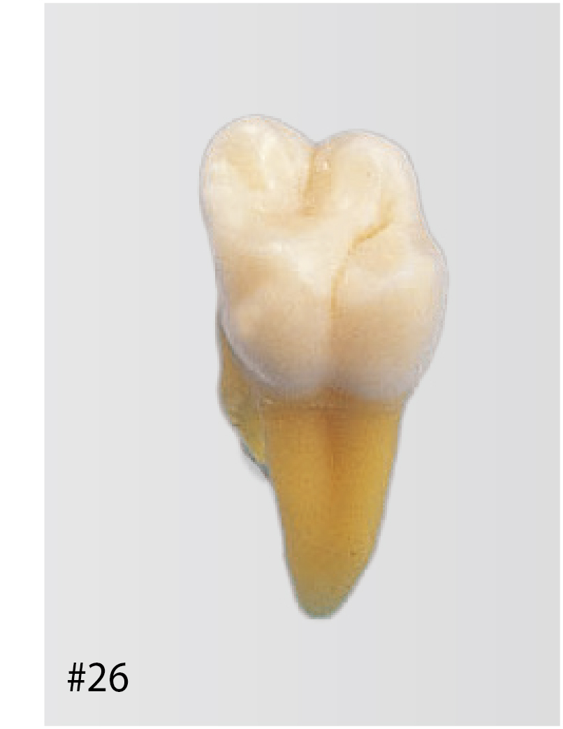 Anatomical Tooth Model [B3-SB.1]