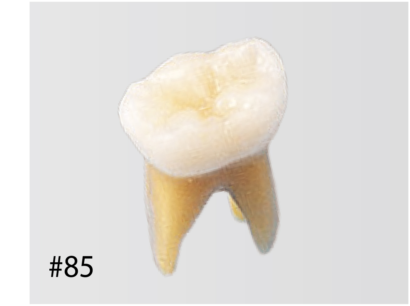 NISSIN ニッシン　B4-309B デンタルモデル 20s Anatomical Primary Tooth Model [B4-309B] | Nissin Dental Products