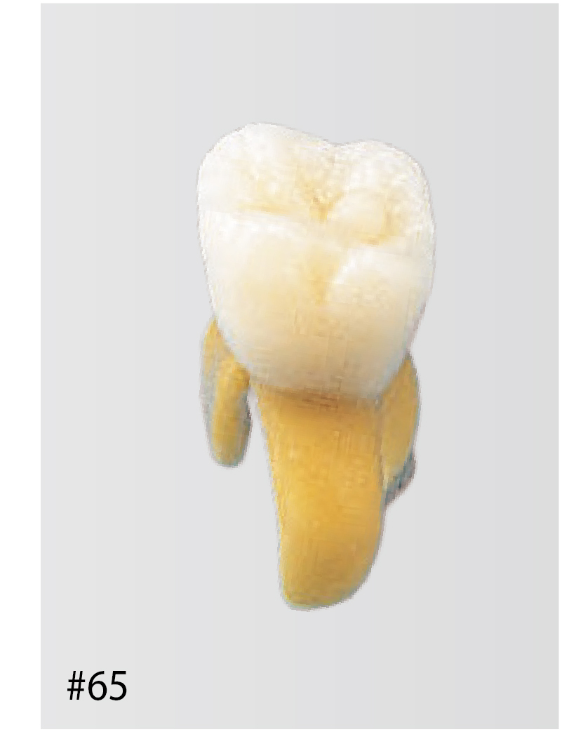Anatomical Primary Tooth Model [B4-309]