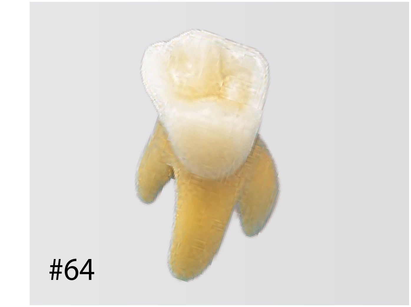 Anatomical Primary Tooth Model [B4-309]