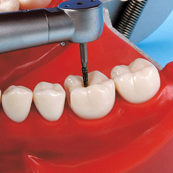 Prosthetic Restoration Jaw Model (32 teeth) [CON2001-UL-HD-FEM-32]