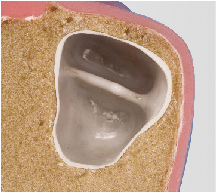 Sinus Lift Practice Model [IMP1007-U-SP]
