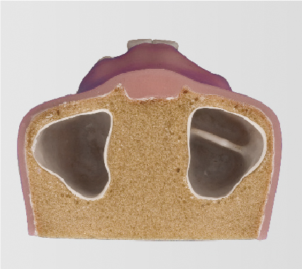 Sinus Lift Practice Model [IMP1007-U-SP]