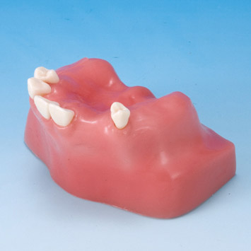 Sinus Lift Practice Model [IMP1007-U-SP]
