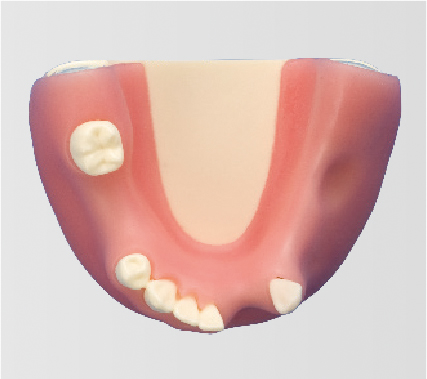 Bone Graft Practice Model [IMP1009-L-SP]