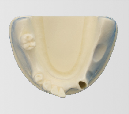 Bone Graft Practice Model [IMP1009-L-SP]