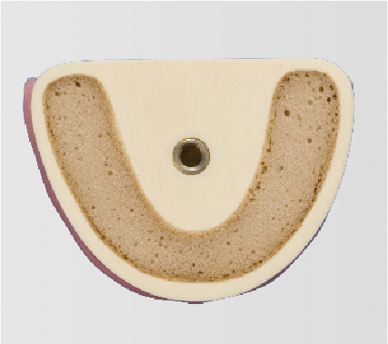 Bone Graft Practice Model [IMP1009-L-SP]