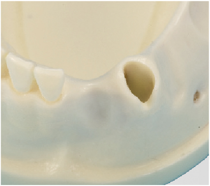 Bone Graft Practice Model [IMP1009-L-SP]