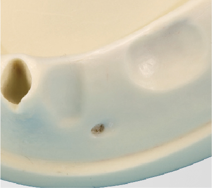Bone Graft Practice Model [IMP1009-L-SP]