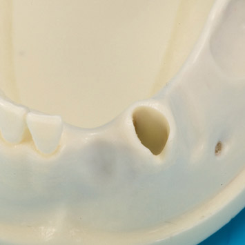 Bone Graft Practice Model [IMP1009-L-SP]