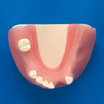 Bone Graft Practice Model [IMP1009-L-SP]