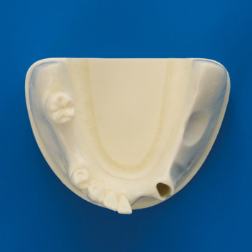 Bone Graft Practice Model [IMP1009-L-SP]