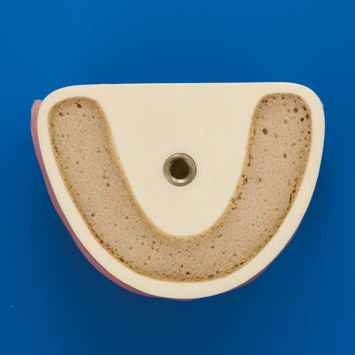 Bone Graft Practice Model [IMP1009-L-SP]