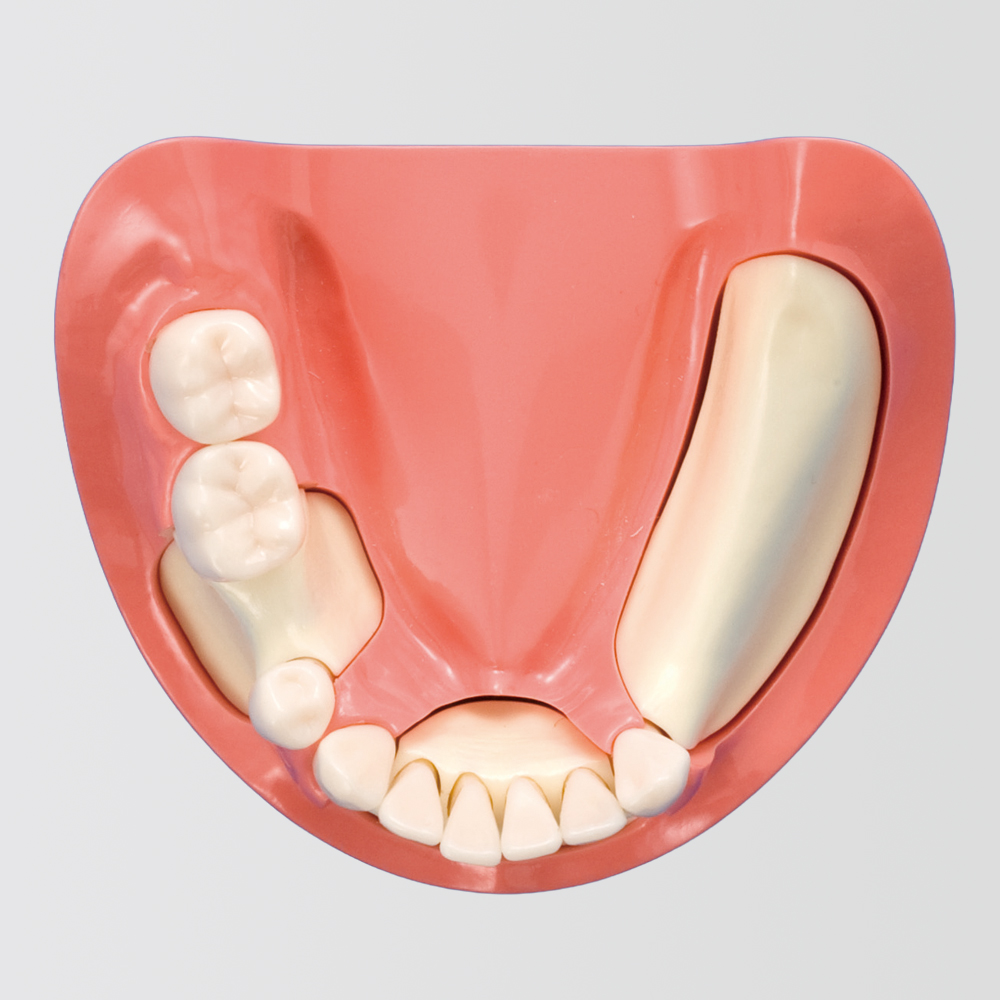 Implant Comprehensive Practice (Maxillary Jaw) [IMP1011-U-SP], (Mandibular Jaw) [IMP1012-L-SP]
