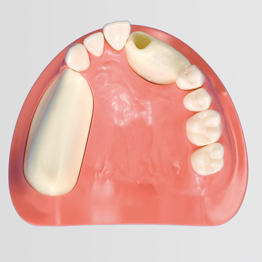 Implant Comprehensive Practice (Maxillary Jaw) [IMP1011-U-SP], (Mandibular Jaw) [IMP1012-L-SP]