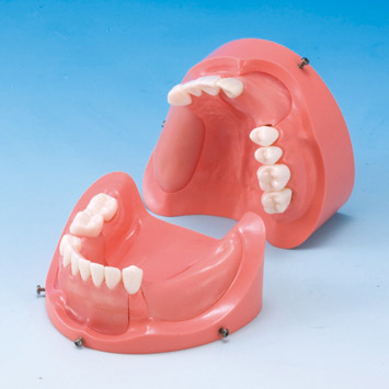 Implant Comprehensive Practice (Maxillary Jaw) [IMP1011-U-SP], (Mandibular Jaw) [IMP1012-L-SP]