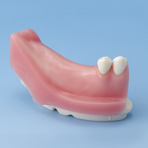 Implant Socket [IMP5003-T]