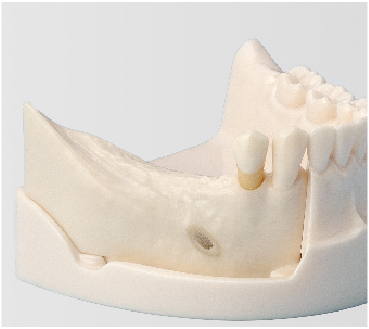 Basic Implant Training Model [IMP5003 Series]