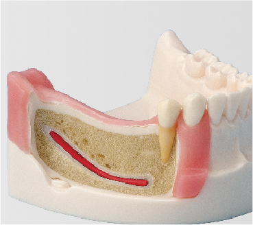 Basic Implant Training Model [IMP5003 Series]