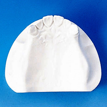 Plaster Jaw Model [MIS-PL Series]