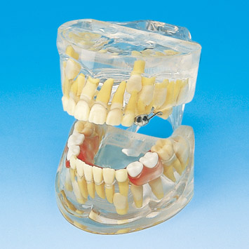 Developmental Study Model [PE-PDI003] (Age 12)