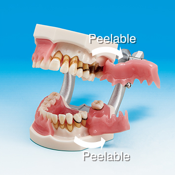 Periodontal Disease Model with Tooth  Mobility [PE-PER003]